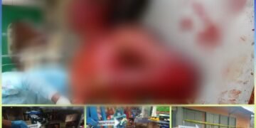 Seorang Pria Tewas Akibat Luka Bacok dan Tikam Di Kompleks Pelabuhan Kayu Kepi